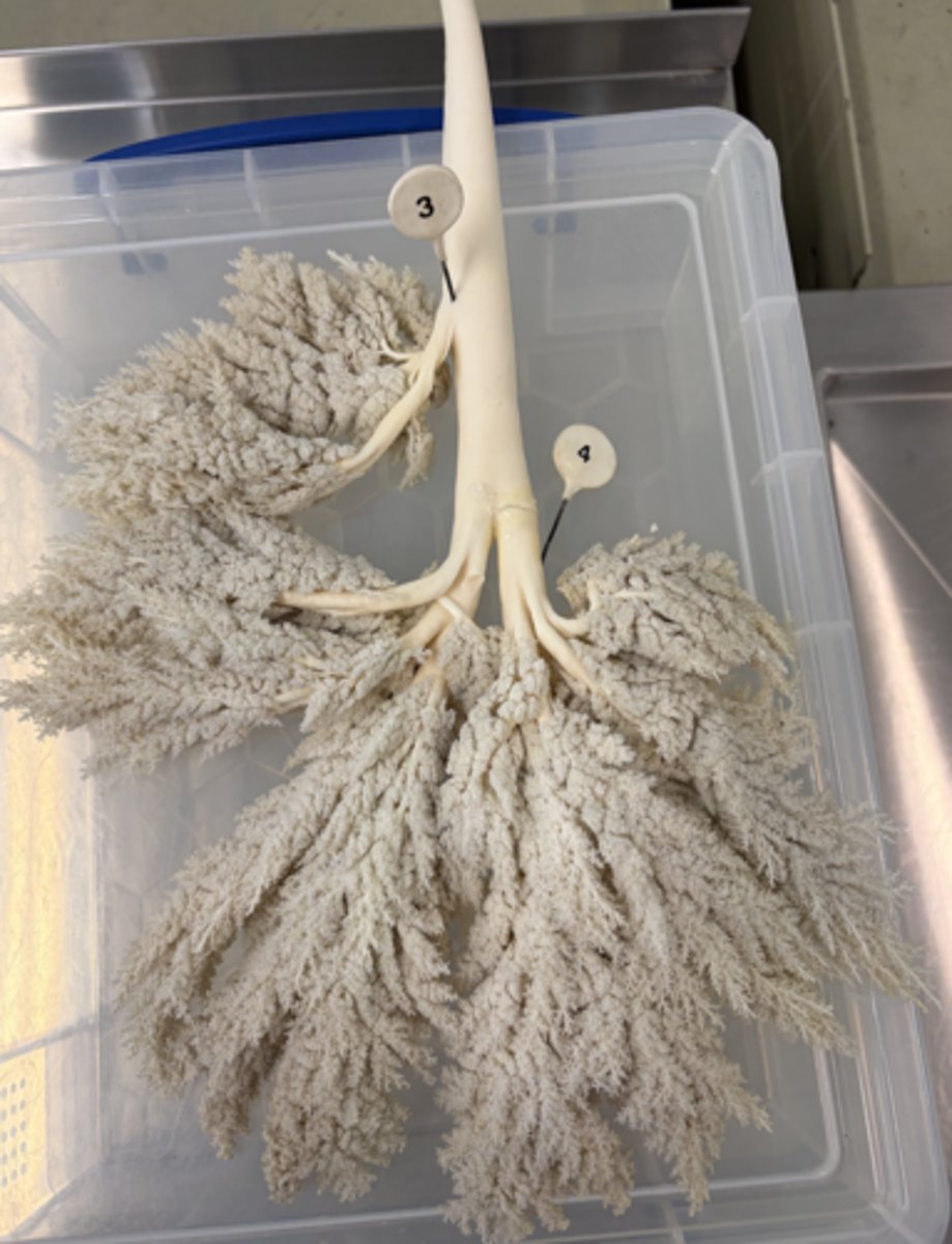 <p>a. Which animals may this endocast have come from?</p><p>b. What type of epithelium lines the lumen of this structure?</p>