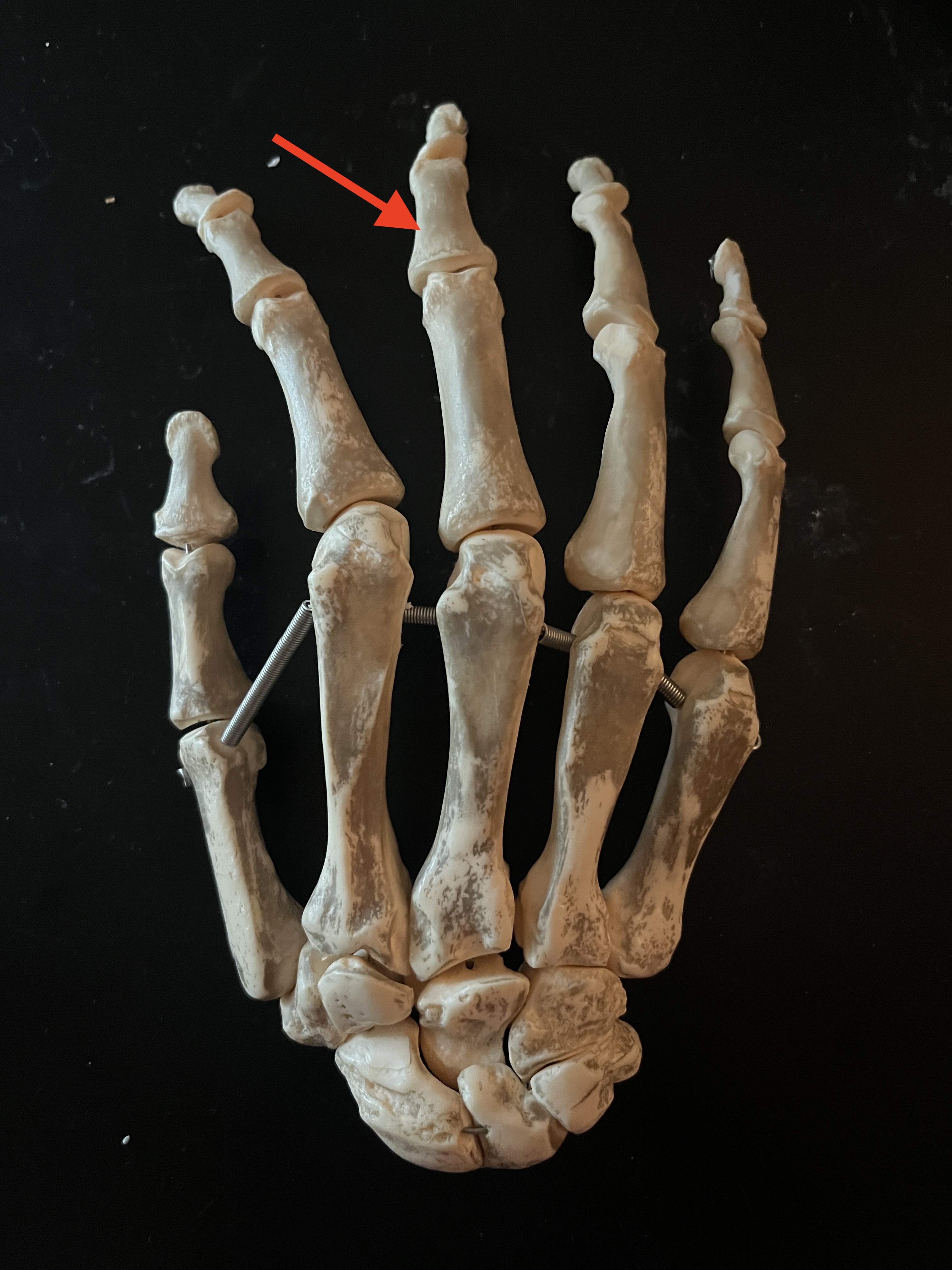 term image