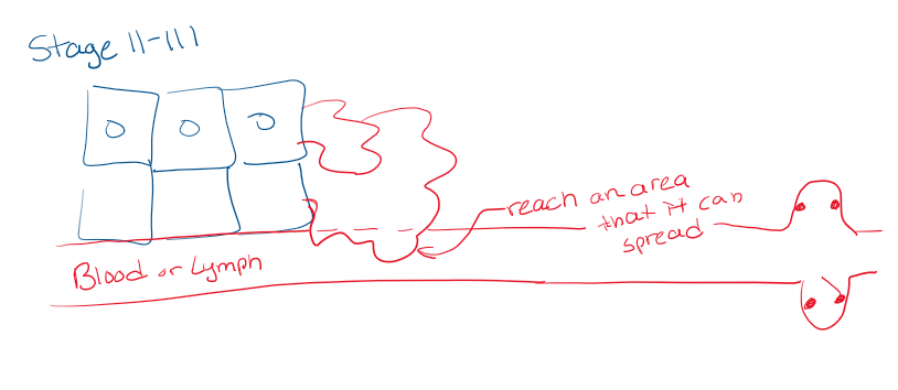 <p>Cancer is present and has spread into nearby tissue.</p><p>For stage 3, the cancer spread further and the tumor is larger</p><ul><li><p>This means it has started to move and invade the rest of the body but hasn’t taken residence</p></li></ul><p></p>