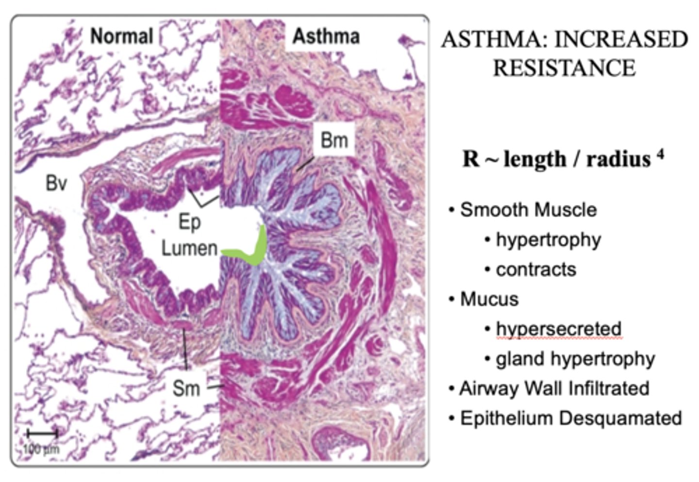 <p>Increase (decreased radius from inflammation)</p>