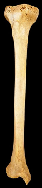 <p>What bone is this?</p><p>Left side or right side?</p><p>(Anterior view).</p>