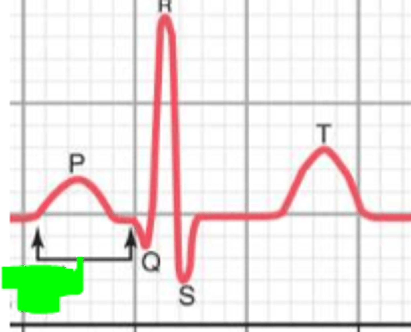 <p>What the does green interval represent?</p>