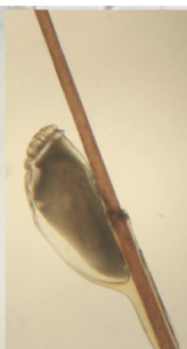 <p>?</p>