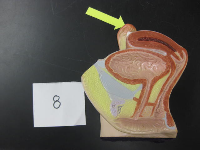 <p>Body Cavities and Body Systems</p><p>Lab Image 1-15</p>