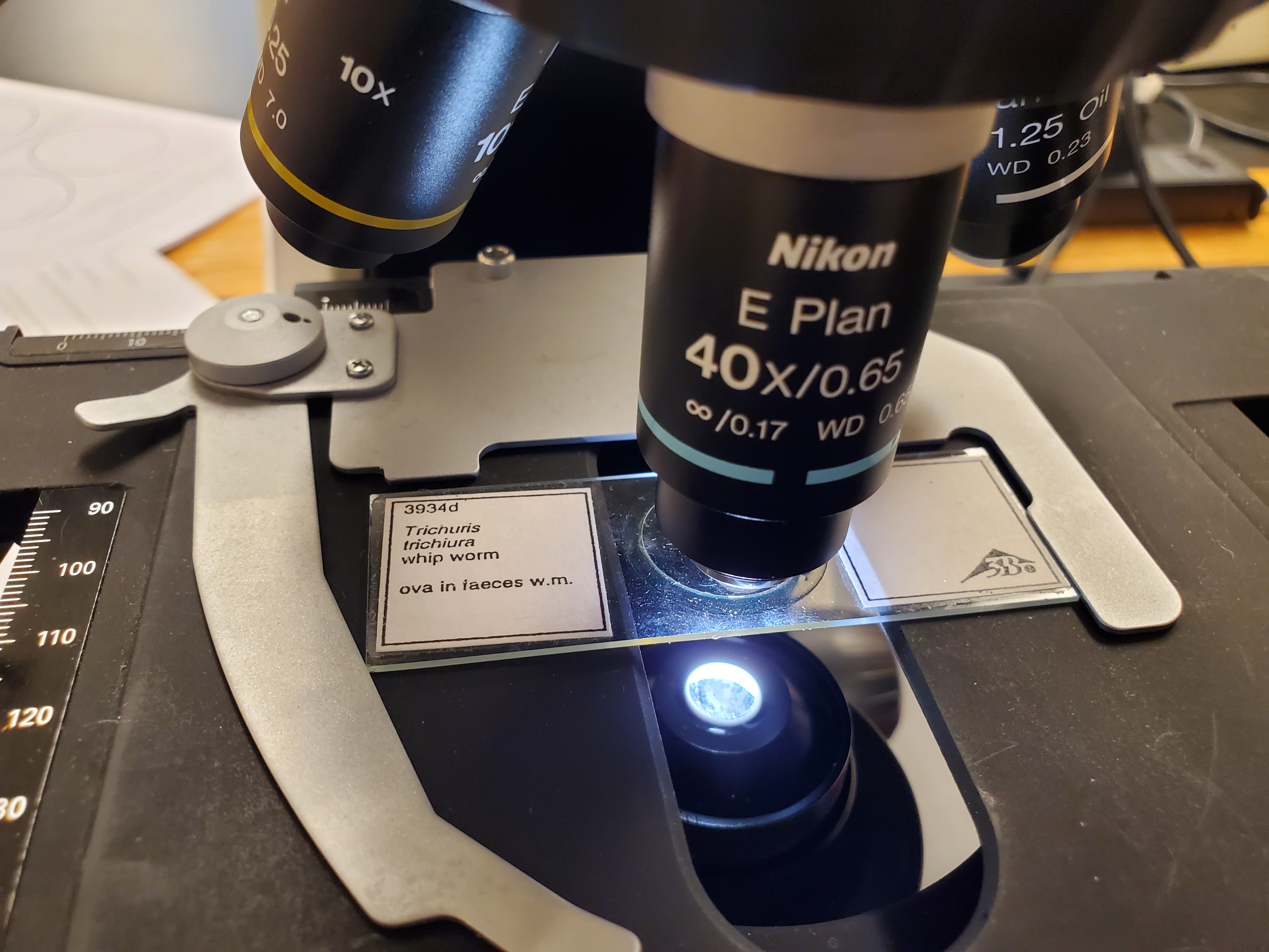 <p>Trichuris trichiura ova</p>