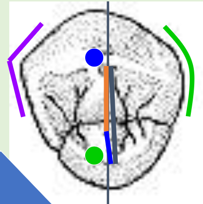 <p>Name the tooth and hi-lighted portions</p>