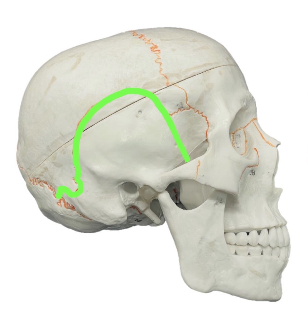 term image