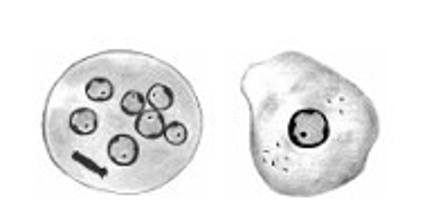 <p>Identify the parasite</p>