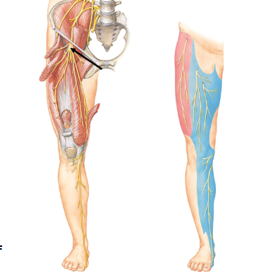 <p>Damage to the Femoral Nerve </p>