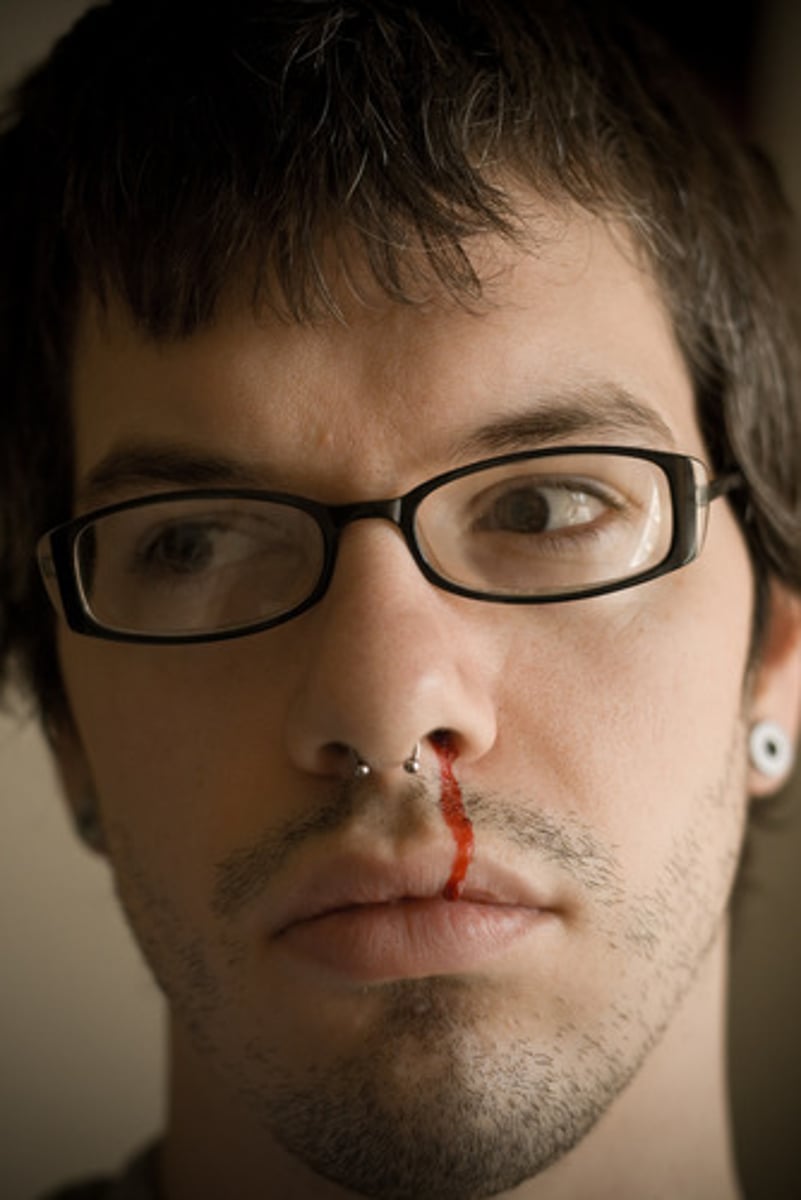 <p>nosebleed</p>