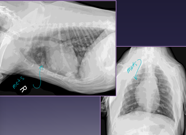 <p>Tumor Staging</p>