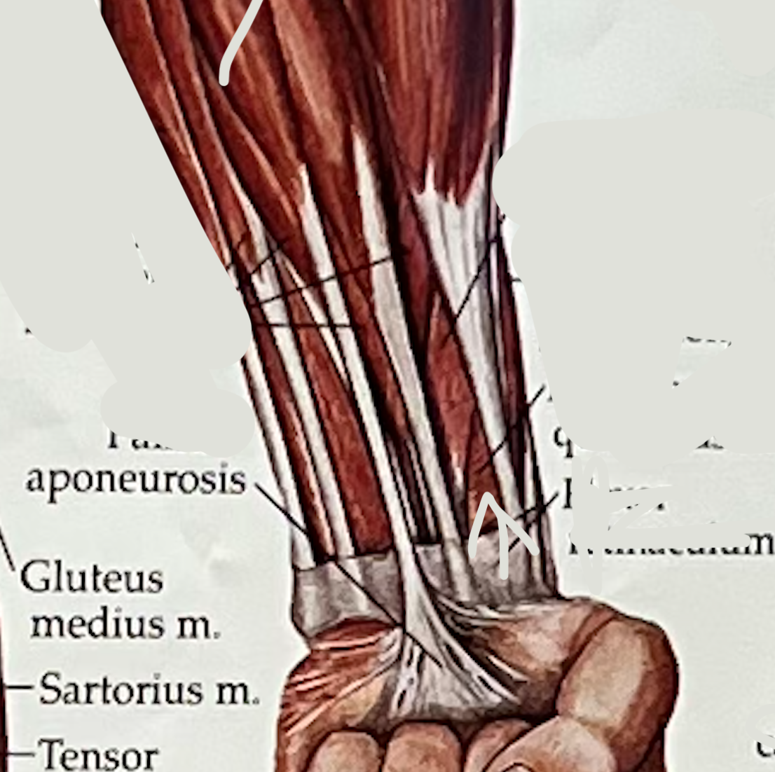 what muscle?