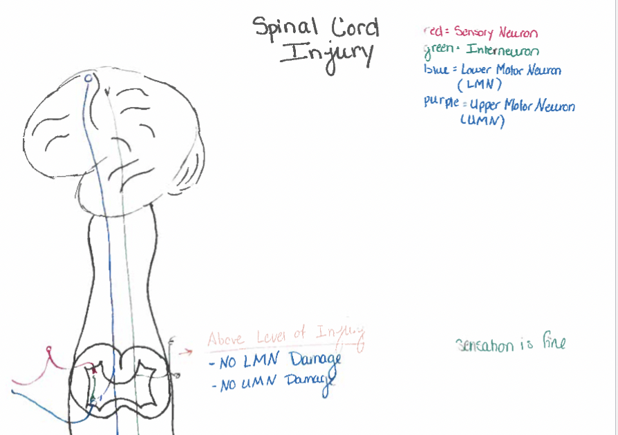 <p>Spinal cord injuries</p>