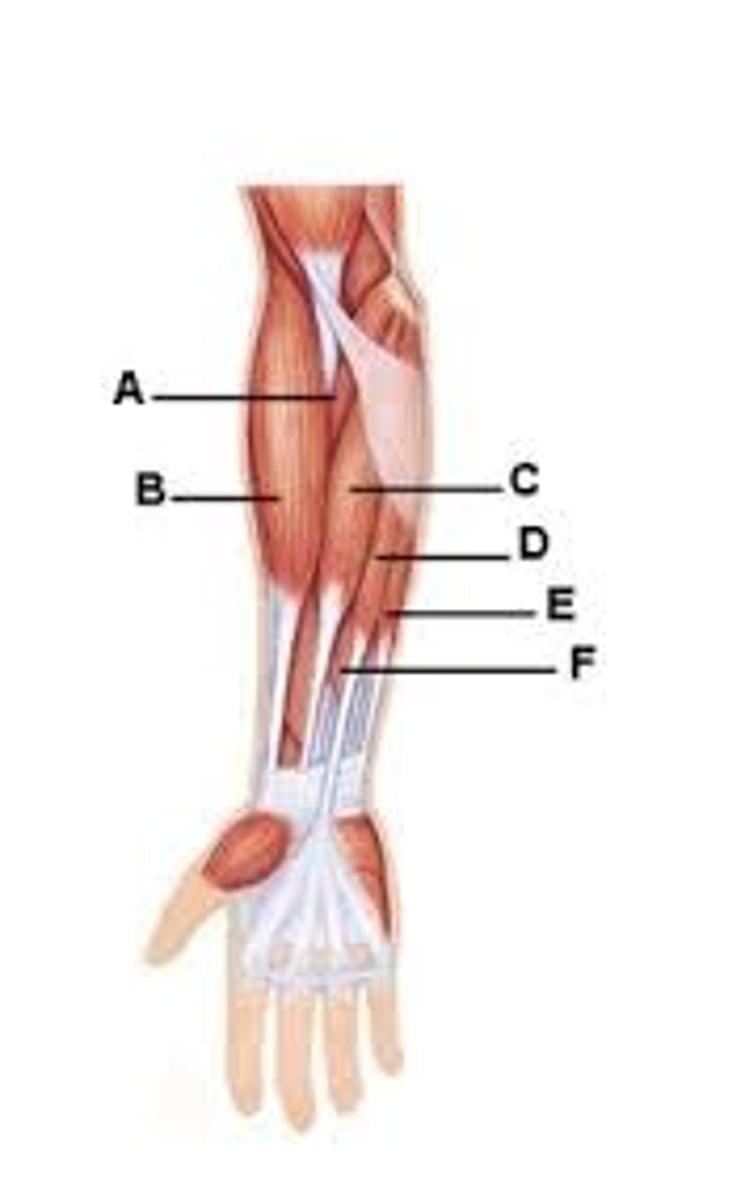 <p>Identify the indicated muscle. (e)</p>