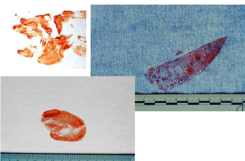 <p>What bloodstain patterns are these?</p>