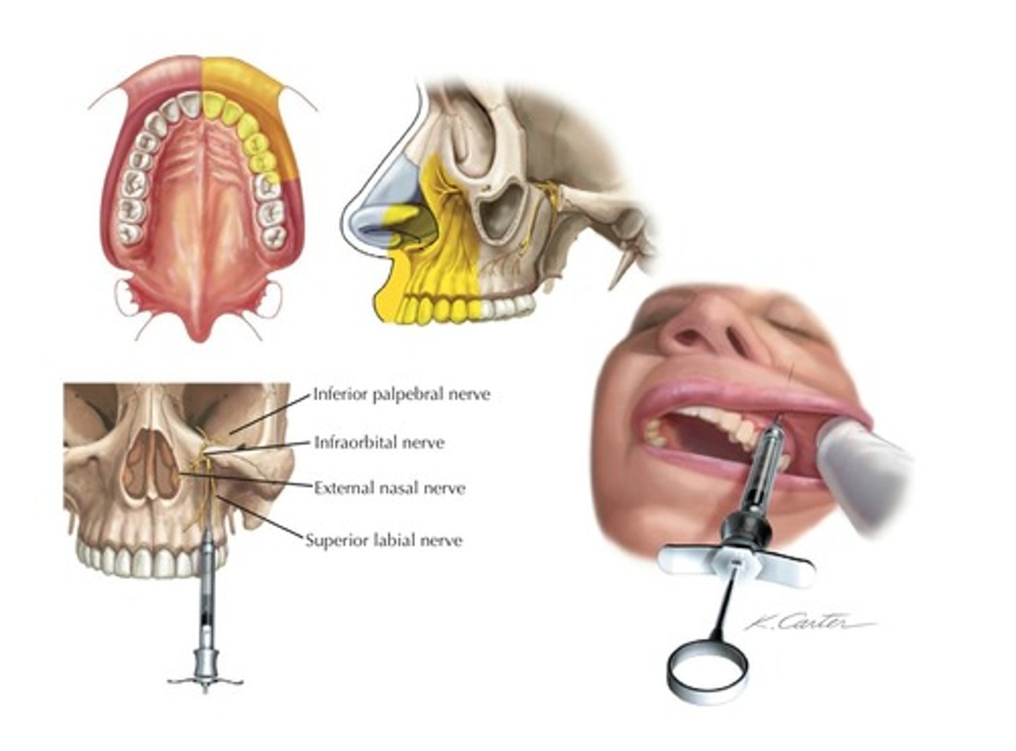 knowt flashcard image