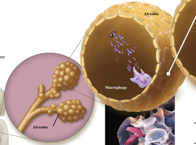 <p><span><span>Agent: </span><em><span>Mycobacterium tuberculosis</span></em></span></p><p><span><span>Acid fast- Cell walls contain mycolic acid, a waxy lipid</span></span></p><p><span style="background-color: transparent;"><span>Grows slowly; Survive phagocytosis from immune cells; Can grow inside cells; </span></span></p><p><span style="background-color: transparent;"><span>Resistant to Gram stains, detergents, common antimicrobial drugs, and drying out</span></span></p>