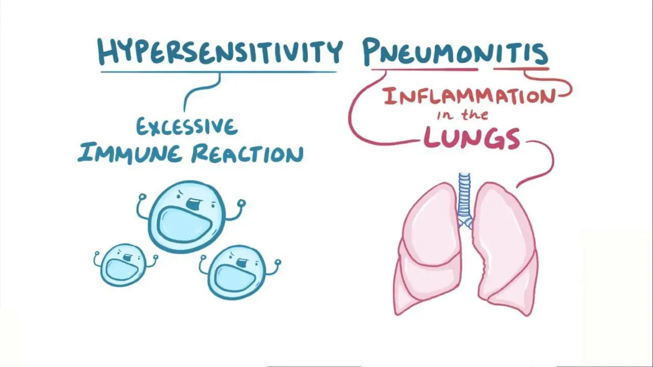 <p>A type of allergic reaction that causes<strong> inflammation in the lungs.</strong></p>