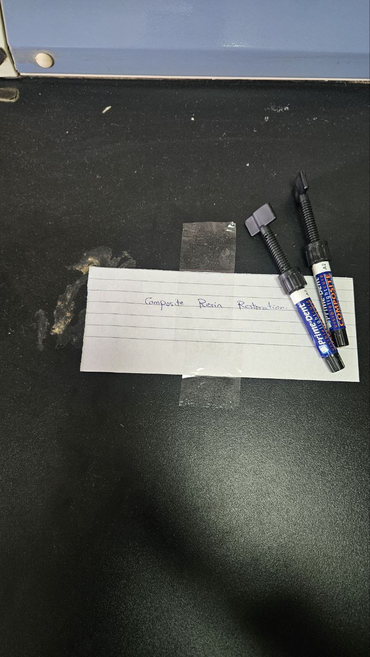 <p>Composite resin restoration</p>