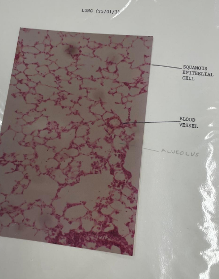 <p>Lung tissue</p>