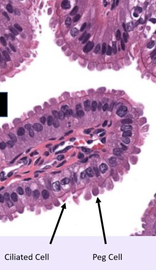 mucosa of oviduct (ampulla)