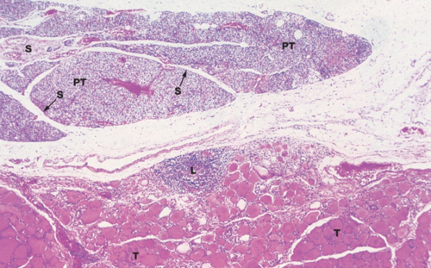 <p>What structure:</p><p>histology: thin capsule with trabeculae that divide parenchyma into lobules</p><p>-lots of capillaries</p>