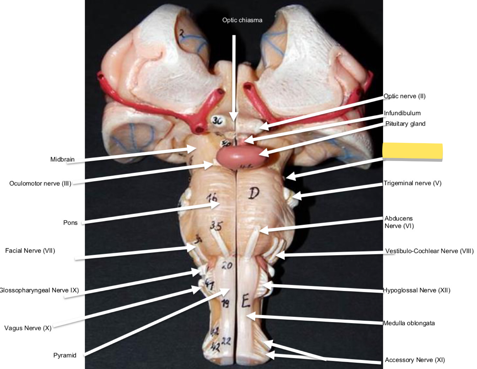 <p>Name this cranial nerve&nbsp;</p>