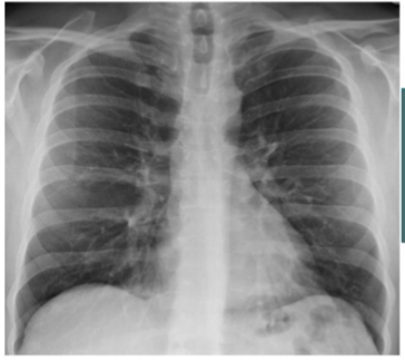 <p>Idenfity R + L hila </p>