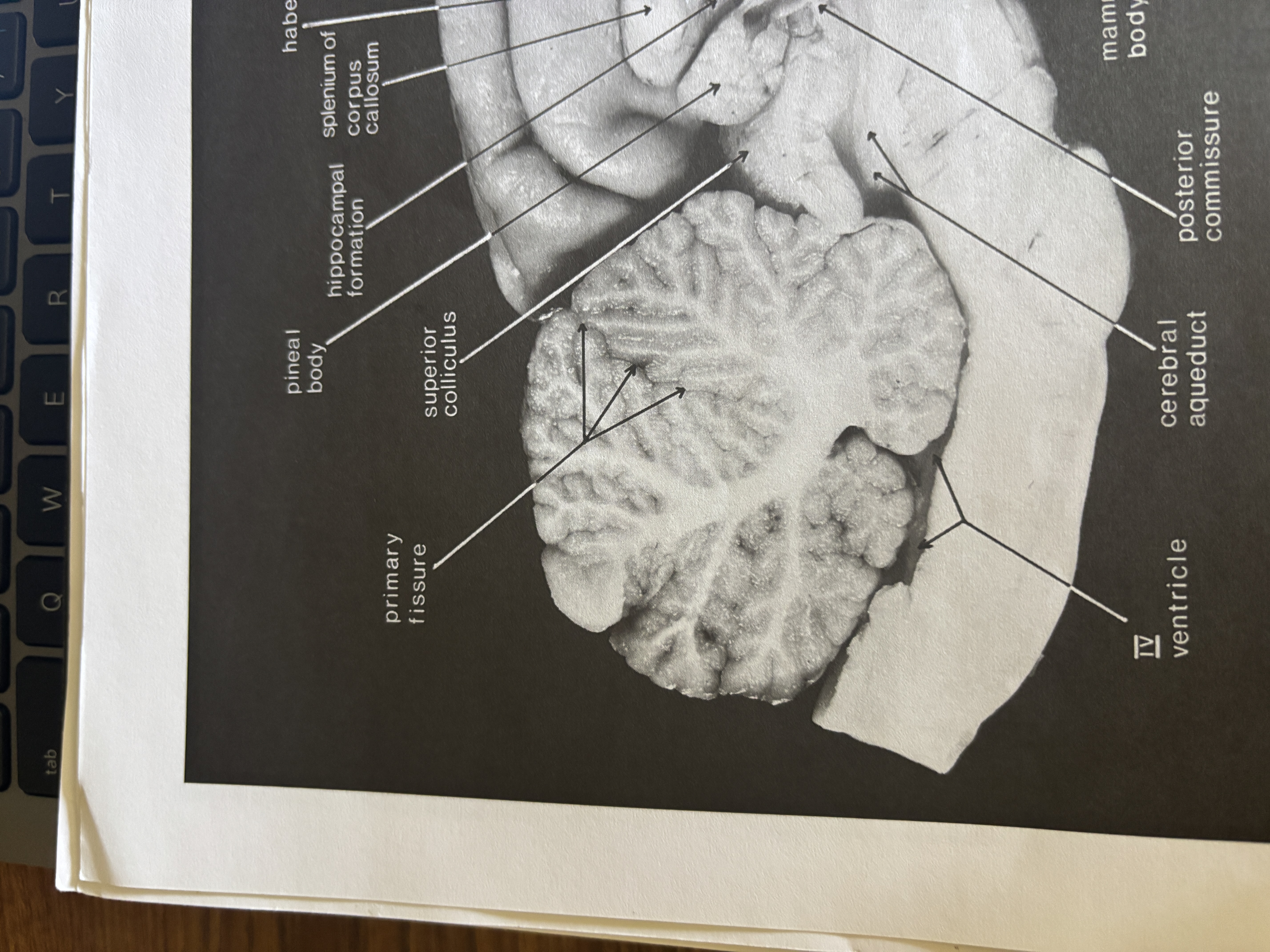 <p>Primary Fissure</p>