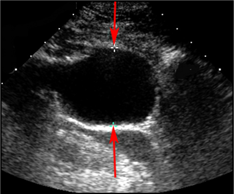 <p>What does this ultrasound refer to</p>