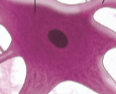 <p>Neurosoma</p>