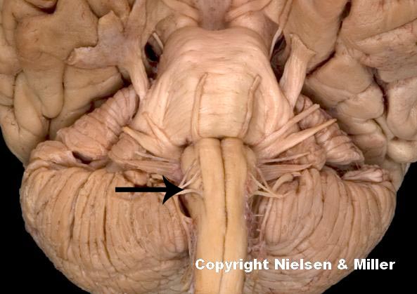 <p>this indicated cranial nerve functions in ____, manipulation of food, swallowing</p>