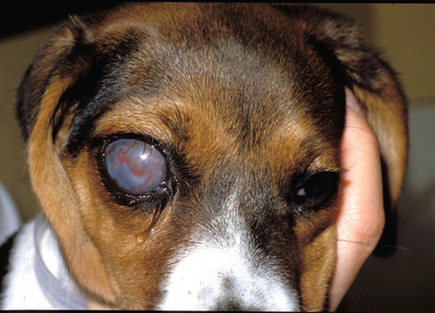 <p>Inc. intraocular pressure (IOP) - 30 mm/Hg or more.</p>