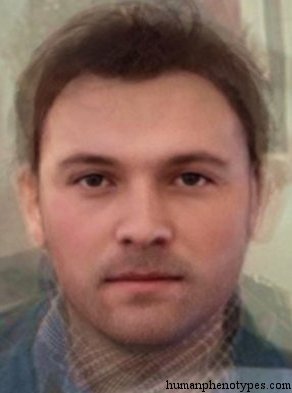 <p>Identify this Phenotype</p>