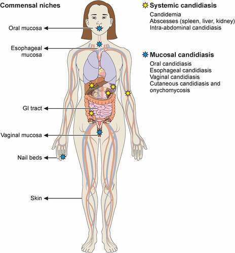 <p>Where are the sites of infection of Candida albicans?</p>