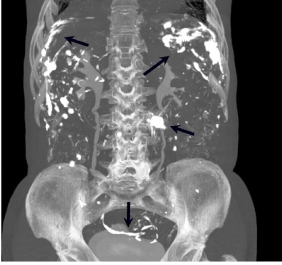 <p>What is this and what type of scan </p>