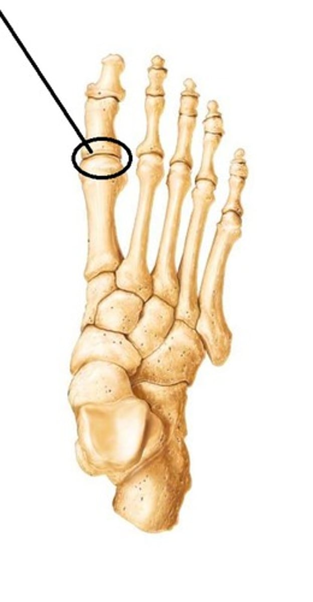 <p>between foot bones and toes</p>