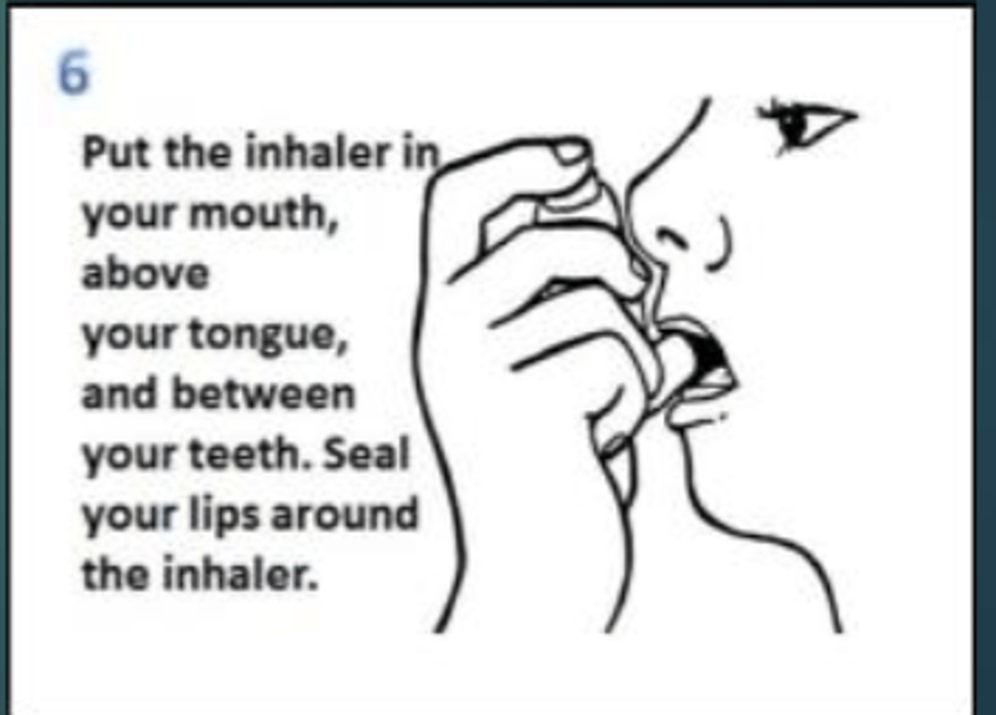 <p>- above the tongue</p><p>- between the teeth</p><p>- seal lips around inhaler</p>
