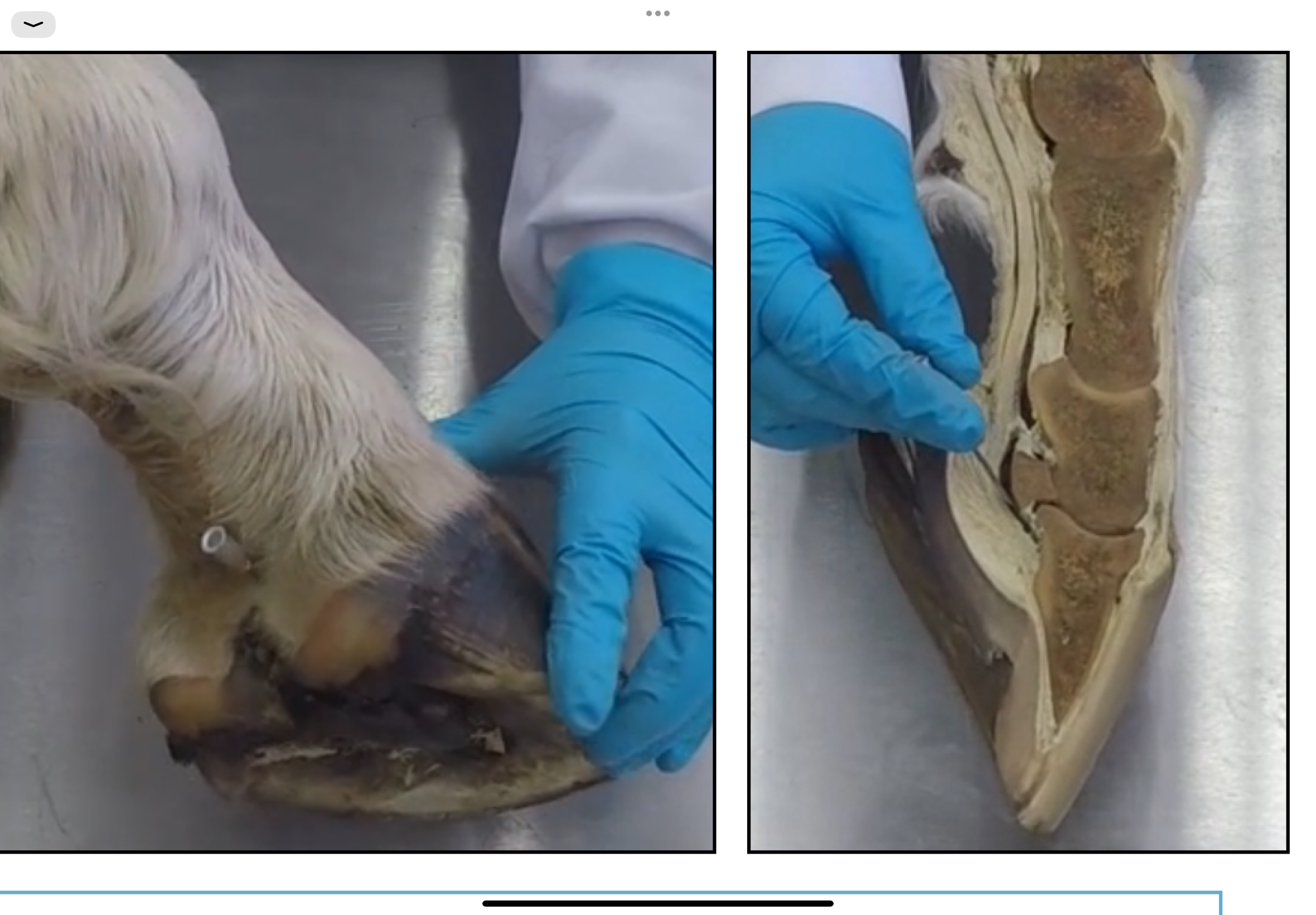 <p>Bourse podotrochléaire:</p><p>- Synoviale tendineuse vésiculaire entre l’os naviculaire (sésamoïde distal) et le tendon fléchisseur profond qui vient coulisser dessus.</p><p>- Ponction dans le creux du paturon mais difficile de savoir si on est dans la bourse → Ponctionner avec une échographie ou une radio</p><p>Maladie naviculaire : Maladie assez fréquente chez les chevaux de sport, qui provoque des boiteries lors du travail, une intolérance au travail, des résultats sportifs déclinants, … à cause de la douleur. Il existe plusieurs formes de la maladie:</p><p>- Forme osseuse : érosion de l’os</p><p>- Forme tendineuse : tendon du Fléchisseur profond atteint</p><p>- Forme ligamentaire : les ligaments qui soutiennent l’os naviculaire qui sont atteints, notamment le ligament impair distal.</p><p>→ On injecte l’anti inflammatoire directement dans la bourse podotrochléaire pour soulager la douleur.</p>