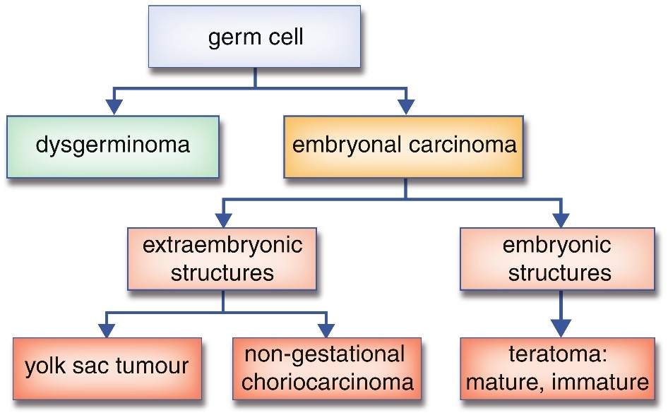 (these are main 2, there are more)

\

1. sex cord stromal tumours

   
   1. pure stromal tumours → ovarian fibroma and ovarian thecoma (or a combo = fibrothecoma)
      * both are benign
      * fibromas → 4% of ovarian neoplasms, mean age of 48
        * presents as a pelvic mass, almost always unilateral
        * macroscopically → smooth outer surface and on cut surface they show a grey-white solid aspect, sometimes with oedema and cystic degeneration
        * hard to elastic consistency
        * microscopically → composed of intersecting bundles of spindle cells with bland nuclei

          often rich in collagen
      * thecomas → 1% of ovarian neoplasms, mean age of 59, unilateral
        * frequently present with oestrogenic symptoms, although androgenic symptoms are also described (go over this\*\*\*)
        * macroscopically → smooth outer surface and a yellow cut surface, due to the presence of steroid hormone producing cells
        * microscopically → composed of sheets of ovoid uniform tumour cells, without nuclear atypia
   2. pure sex cord tumours → granulosa cell tumours
      * best known form is adult granulosa cell tumour (juvenile is rare)
      * 1% of all ovarian tumours, mean age of 53 (but wide range)
      * present in postmenopausal women with vaginal blood loss
      * present in younger patients with bleeding disorders such as menorrhagia or amenorrhoea, sometimes presents with virilisation (in both ages or?)
      * normally unilateral, 10 cm but can vary
      * macroscopically → outer surface is smooth, cut surface shows a mixture of solid and cystic areas with weak consistency and tan to yellow colour
      * microscopically → different growth patterns

        → often trabeculae, sheets and cords of cell with palte cytoplasm and a centrally located round to slightly irregular nucleus, with a bland appearance and classically a nuclear groove
      * clinical course is that of a low-grade malignant tumour
      * intraperitoneal recurrences or lymph node metastases can be found after long intervals, sometimes exceeding 5 years or more
2. germ cell tumours:

   
   1. benign germ cell tumours:
      * consist of mature teratomas derived from 1 germ layer (monodermal teratomas) and those derived from 2 or 3 germ layers (mature cystic teratomas, formerly known as dermoid cysts)
      * mature cystic teratomas are frequently seen, accounting for 20 % of the ovarian tumours
      * can occur at any age but are mostly seen during reproductive ages
      * macroscopically → cysts, often filled sebaceous material, frequently combined with hair
      * cyst wall may contain a solid elevation, in which the presence of nearly all tissue types is described
      * may occur with primary ovarian mucinous tumours
   2. malignant germ cell tumours:
      * immature teratomas can present as a mature cystic teratoma, in which a microscopic proportion of immature tissue is present
      * otherwise the tumour consists almost entirely of immature tissue which usually has primitive neuro-ectodermal tissue
      * although CT may be needed, prognosis is good
   * dysgerminoma:
     * most common ovarian germ cell tumours
     * = a primitive germ cell tumour consisting of tumour cells without features of differentiation
     * mean age of 22
     * macroscopically → >10 cm, consist of a solid mass with a soft and tan appearance
     * haemorrhage and necrosis or degeneration is frequently present
     * microscopically → consists of sheet and solid areas of undifferentiated large tumour cells, with large nuclei and a high mitotic count
     * often also contains lymphocytes
     * male counterpart = seminoma
   * most present with a fast growing abdominal mass, often accompanied by abdominal pain due to haemorrhage or necrosis
   * extremely sensitive to CT