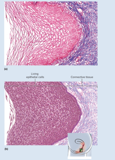 <p>same as keratinized epithelium but without the surface layer of dead cells</p>