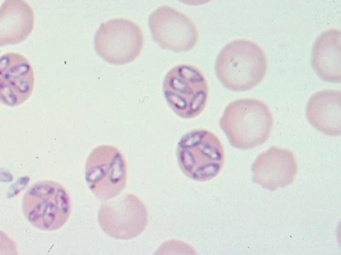 <p>What is the following parasite?</p>