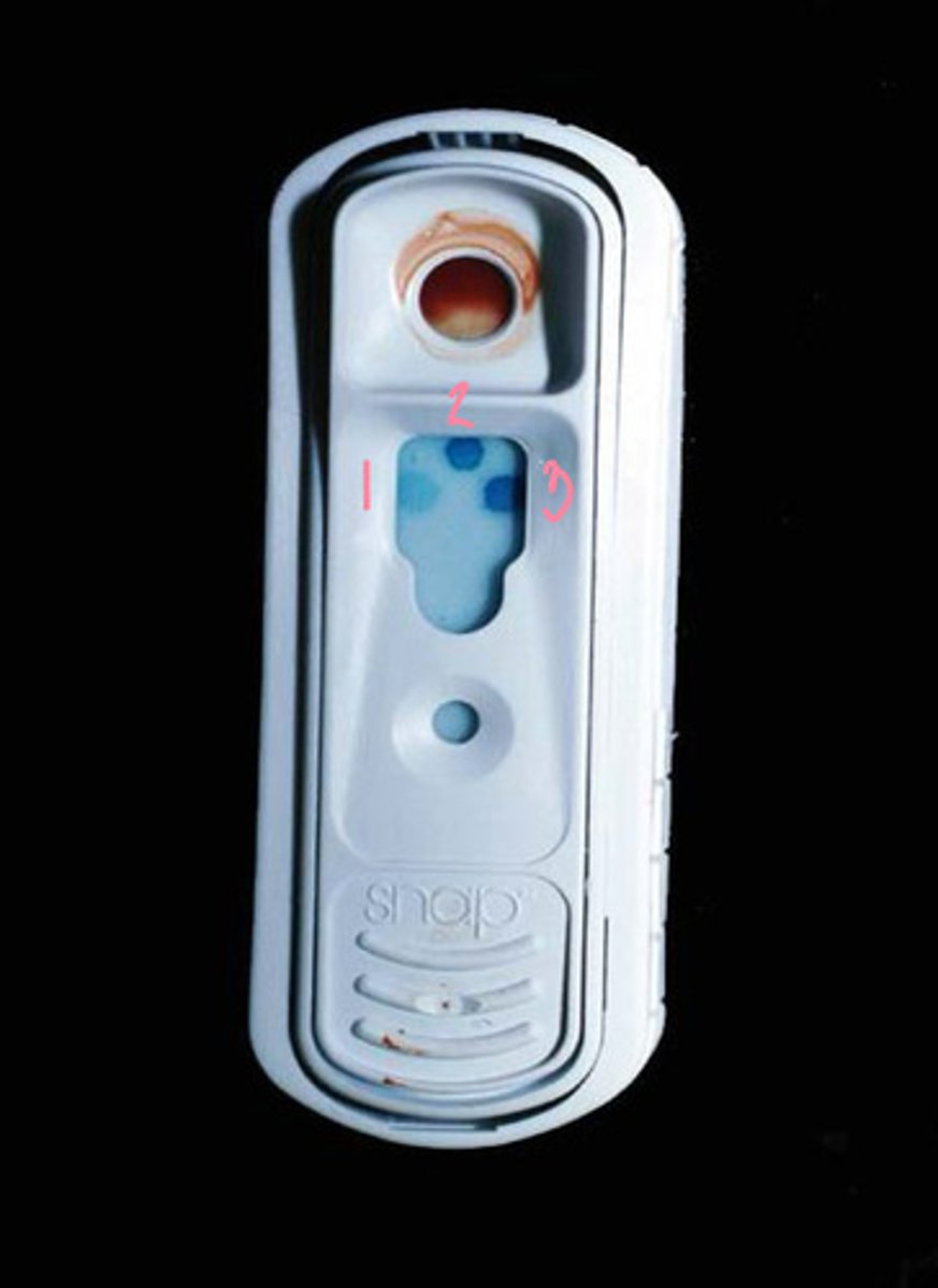 <p>This test is testing the blood of a foal. What is this being used to test for, and what do each of the dots mean?</p>