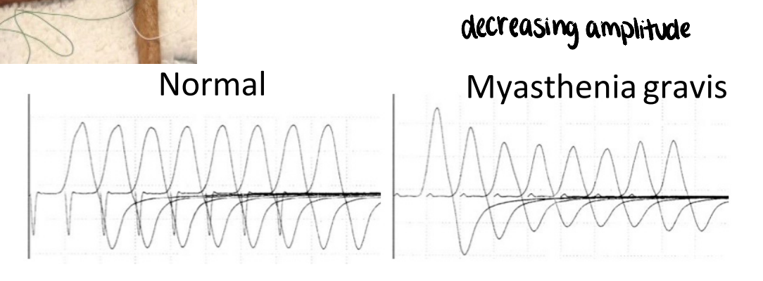 <ul><li><p><strong>detection of antibodies to acetylcholine receptor (gold standard)</strong></p></li><li><p>physical exam &amp; radiographs (megaesophagus ± chest mass [thymoma])</p></li><li><p>tensilon response test</p><ul><li><p>inhibits acetylcholinesterase → acetylcholine can remain longer in the synaptic cleft &amp; stimulate any remaining receptors</p></li><li><p>currently not being manufactured</p></li></ul></li><li><p>electromyogram</p><ul><li><p>decreasing amplitude</p></li></ul></li></ul><p></p>