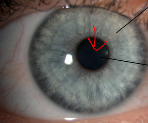<p>What part of the eye is this</p>