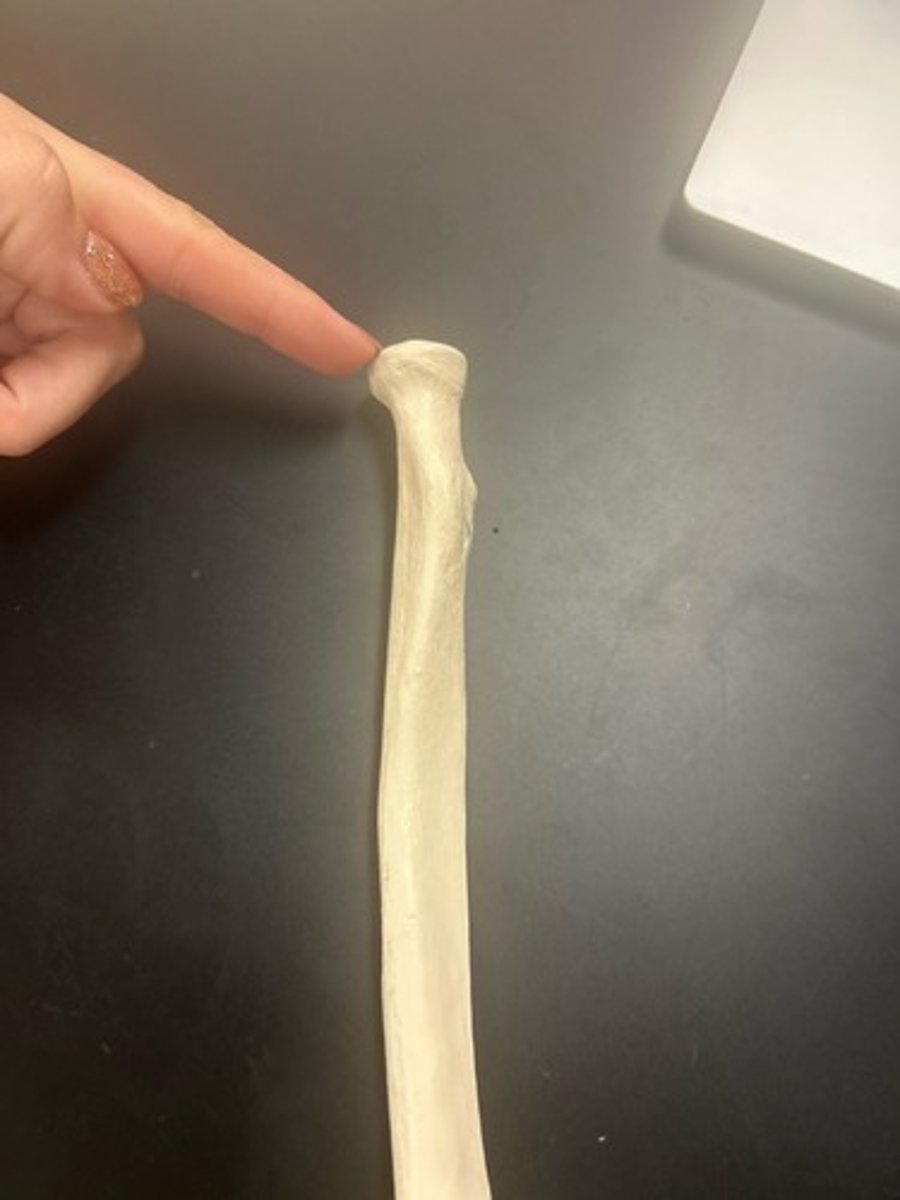 <p>name the bone</p>