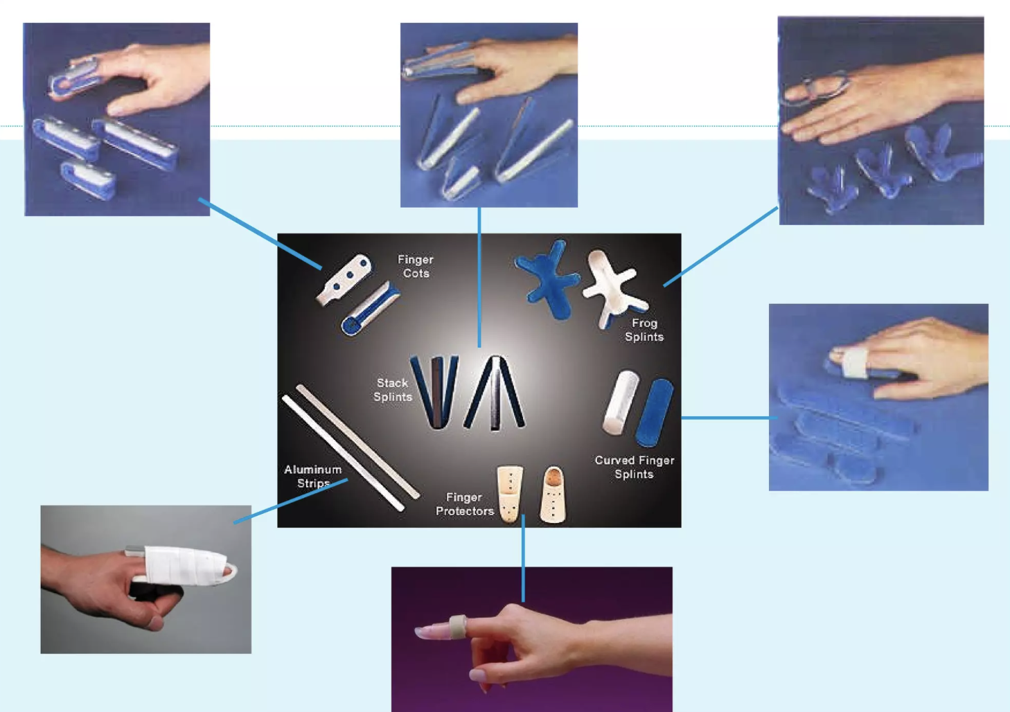 <p>- provide three point static control to prevent certain position and allow movement in the opposite position </p>
<p>- the combination of static control in both surfaces immobilizes the finger </p>