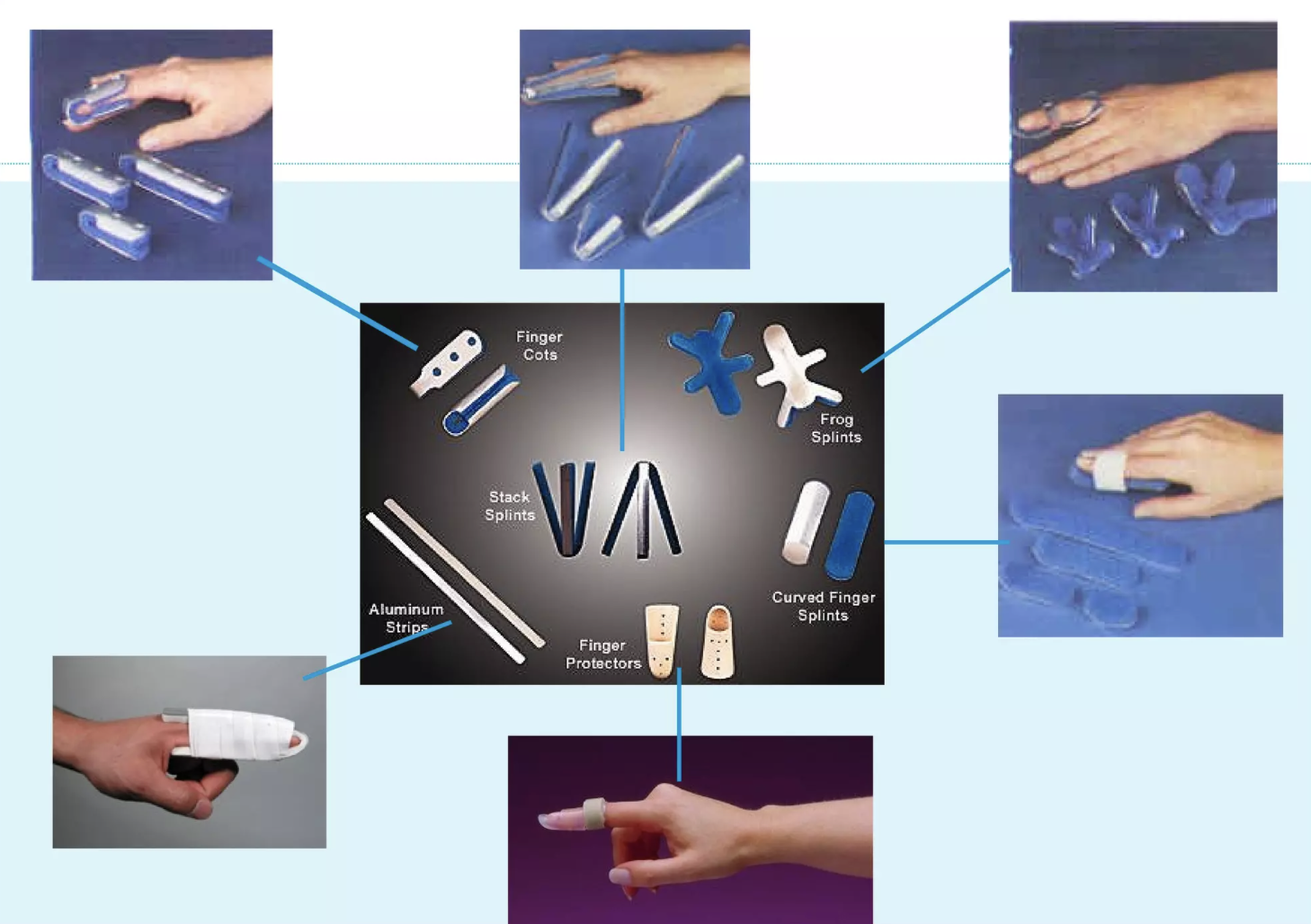 <p>- provide three point static control to prevent certain position and allow movement in the opposite position</p><p>- the combination of static control in both surfaces immobilizes the finger</p>