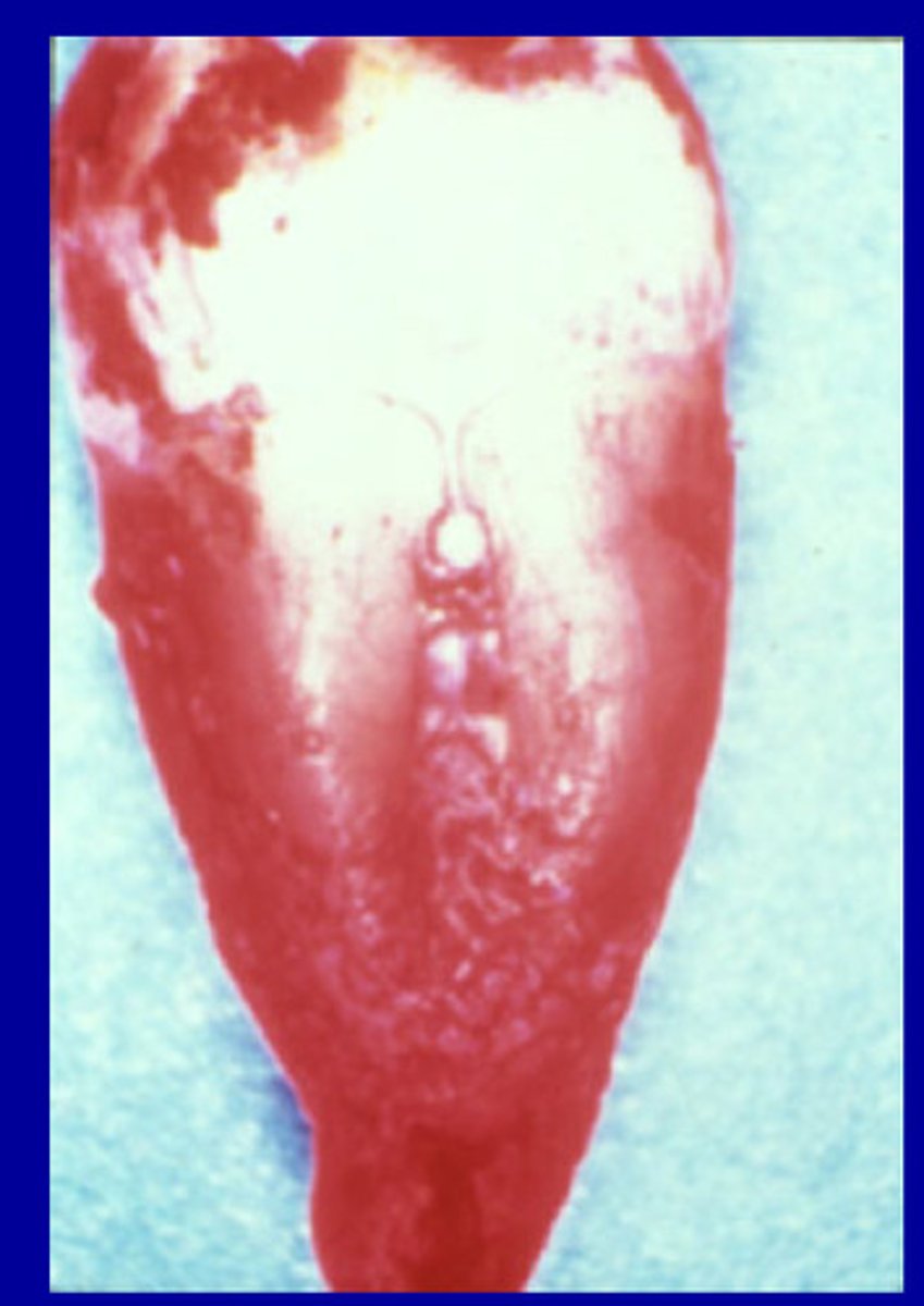 <p>small masses of excess enamel on the surface of teeth located APICALLY to the CEJ</p>