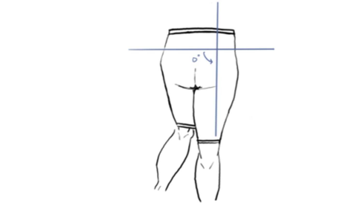 <p>IM: Abduction (Glute medius)</p><p>EM: Adduction</p><p>IM&gt;EM (concentric)</p><p>Angle = 0° neutral</p>